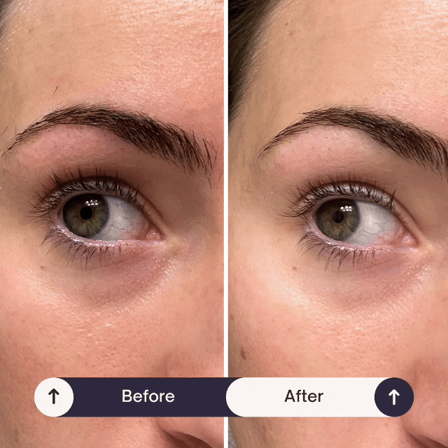 MEDIGLOW™ 24k Under Eye Patches