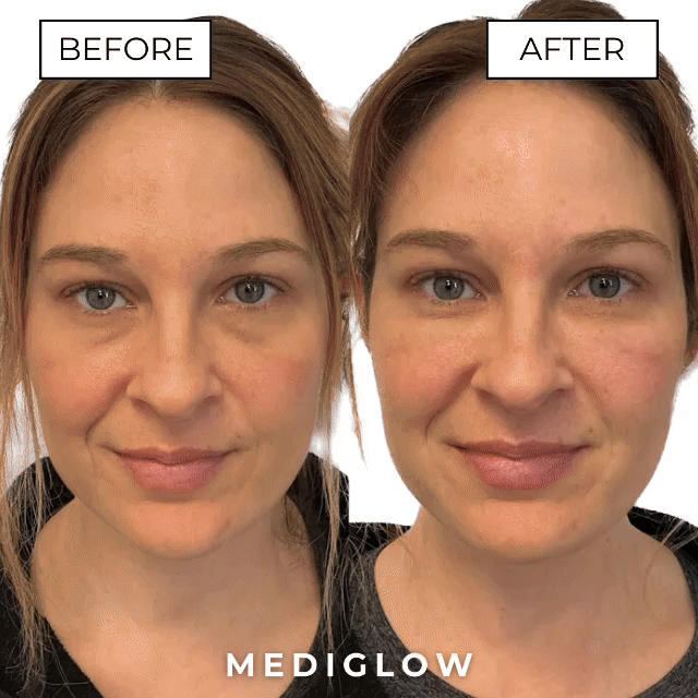 MEDIGLOW™ Under Eye Glasses