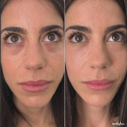 MediGlow Repair Serum
